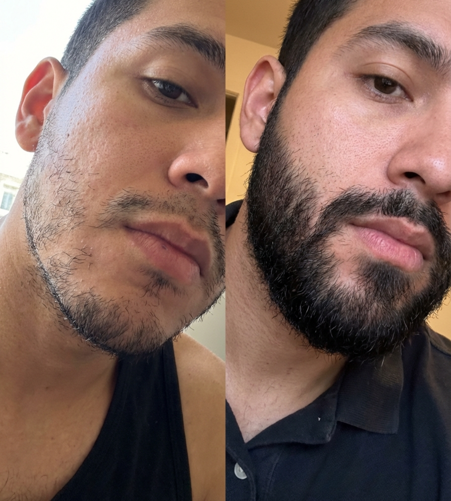 APOLO Ultra Potente – Bálsamo para Crecimiento de Barba | 100 mL